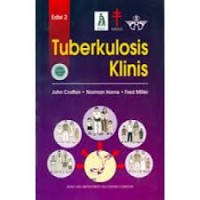 Image of TUBERKULOSIS KLINIS